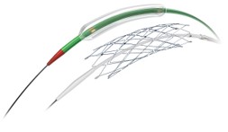 Wingspan Stent System and Gateway PTA Balloon Catheter - Designed for Intracranial Atherosclerotic Disease by Stryker